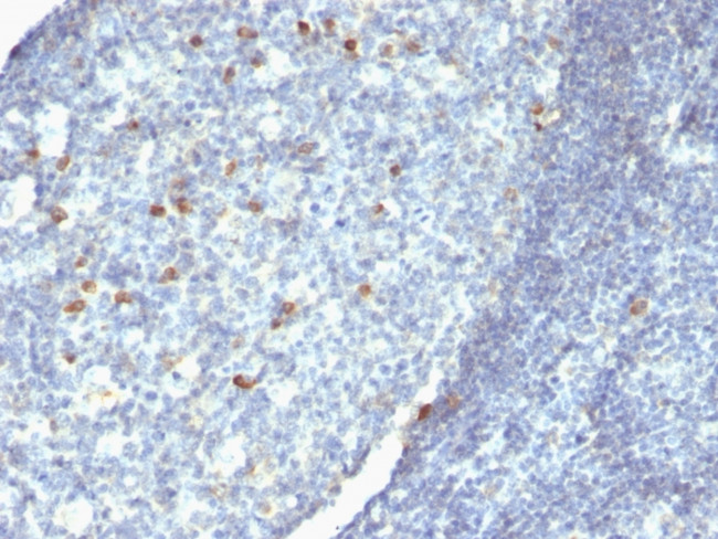 IgM (Immunoglobulin Mu Heavy Chain) (B-Cell Marker) Antibody in Immunohistochemistry (Paraffin) (IHC (P))