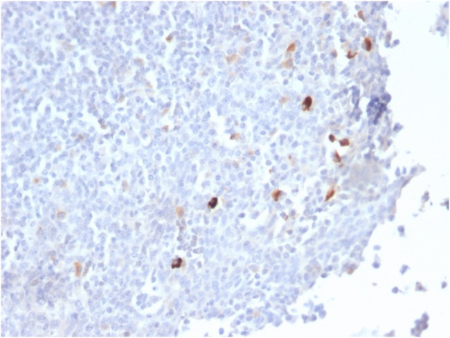 IgM (Immunoglobulin Mu Heavy Chain) Antibody in Immunohistochemistry (Paraffin) (IHC (P))