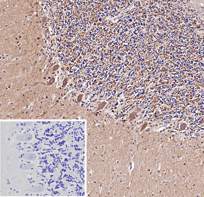 beta Amyloid Antibody in Immunohistochemistry (Paraffin) (IHC (P))