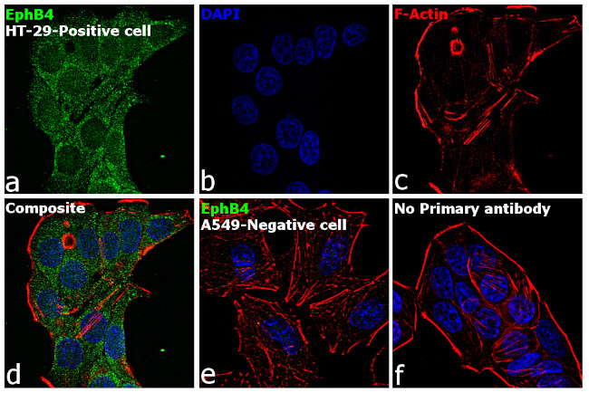 EphB4 Antibody in Immunocytochemistry (ICC/IF)