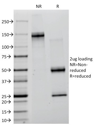 Lambda Light Chain (B-Cell Marker) Antibody in SDS-PAGE (SDS-PAGE)