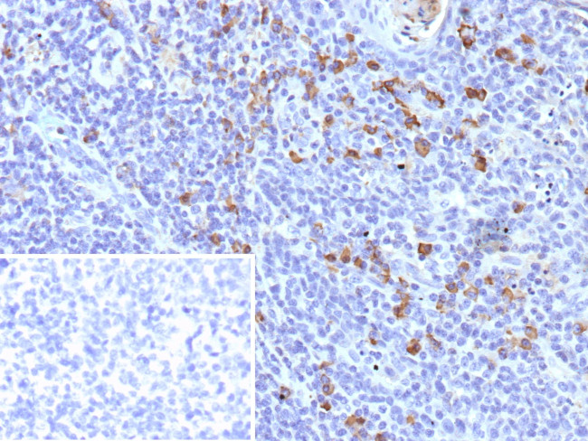 Lambda Light Chain (B-Cell Marker) Antibody in Immunohistochemistry (Paraffin) (IHC (P))