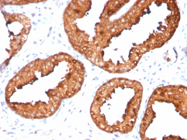 Prostate Specific Antigen (PSA) Antibody in Immunohistochemistry (Paraffin) (IHC (P))