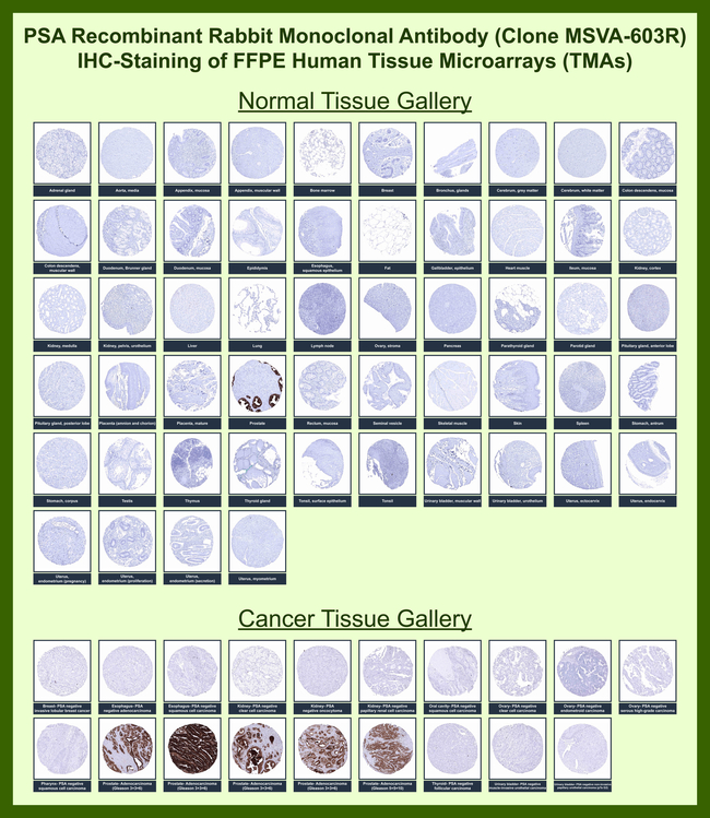 Prostate Specific Antigen (PSA) Antibody in Immunohistochemistry (Paraffin) (IHC (P))