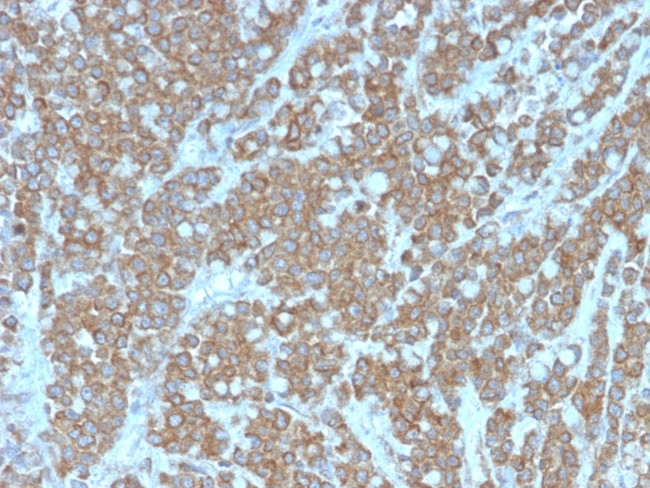 Interleukin-1 alpha (IL-1 alpha) Antibody in Immunohistochemistry (Paraffin) (IHC (P))