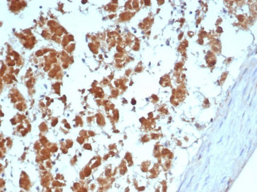 Interleukin-1 beta (IL-1 beta) Antibody in Immunohistochemistry (Paraffin) (IHC (P))