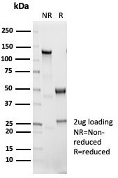 Interleukin-1 beta (IL-1 beta) Antibody in SDS-PAGE (SDS-PAGE)