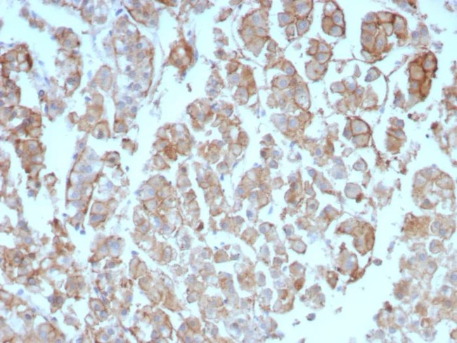 Interleukin-2 (IL-2) Antibody in Immunohistochemistry (Paraffin) (IHC (P))