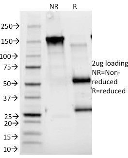 CD25/IL2RA (Activated Lymphocyte Marker) Antibody in SDS-PAGE (SDS-PAGE)