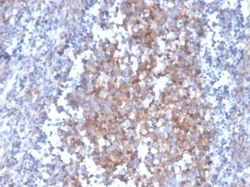 Fas Ligand (FASLG) Antibody in Immunohistochemistry (Paraffin) (IHC (P))