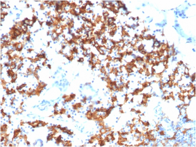 IL3RA/CD123 (Acute Myeloid Leukemia Marker) Antibody in Immunohistochemistry (Paraffin) (IHC (P))