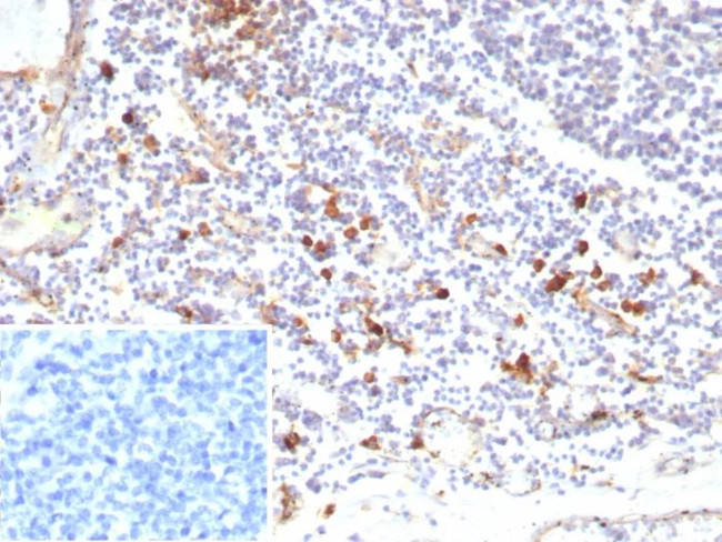 IL3RA/CD123 (Acute Myeloid Leukemia Marker) Antibody in Immunohistochemistry (Paraffin) (IHC (P))
