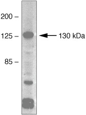 VEGF Receptor 1 (soluble) Antibody in Western Blot (WB)