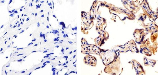 VEGF Receptor 3 Antibody in Immunohistochemistry (Paraffin) (IHC (P))