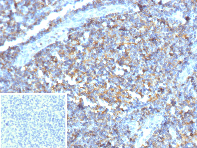 CD137/4-1BB/TNFRSF9 (Marker of Activated T Cells & NK Cells) Antibody in Immunohistochemistry (Paraffin) (IHC (P))