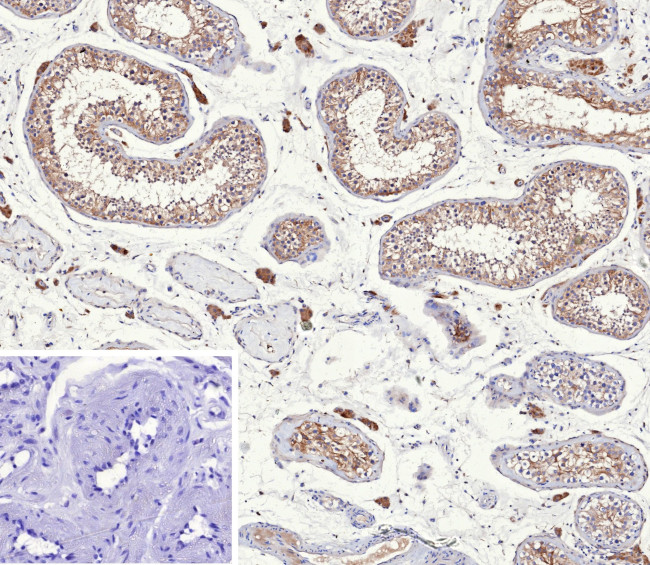 Inhibin, alpha (INHA) (Gonadal Cell Marker) Antibody in Immunohistochemistry (Paraffin) (IHC (P))