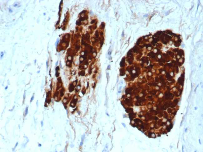 Inhibin, alpha (INHA) Antibody in Immunohistochemistry (Paraffin) (IHC (P))