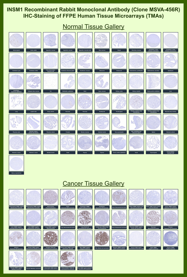 INSM1 (Pan-Neuroendocrine Marker) Antibody in Immunohistochemistry (Paraffin) (IHC (P))