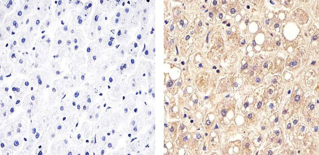 Claudin 14 Antibody in Immunohistochemistry (Paraffin) (IHC (P))