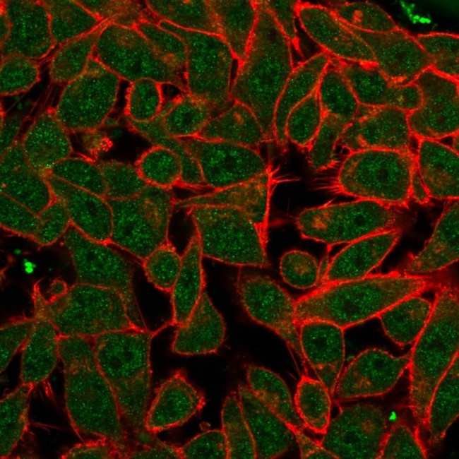 Pancreatic duodenal homeobox-1 protein (PDX1) Antibody in Immunocytochemistry (ICC/IF)