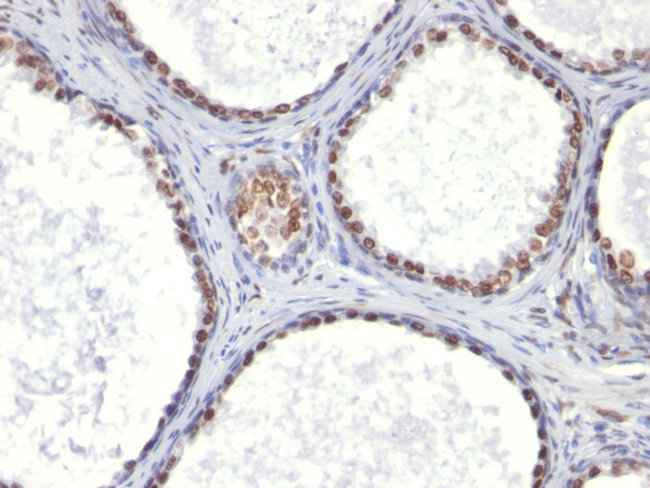 Androgen Receptor (Marker of Androgen Dependence) Antibody in Immunohistochemistry (Paraffin) (IHC (P))