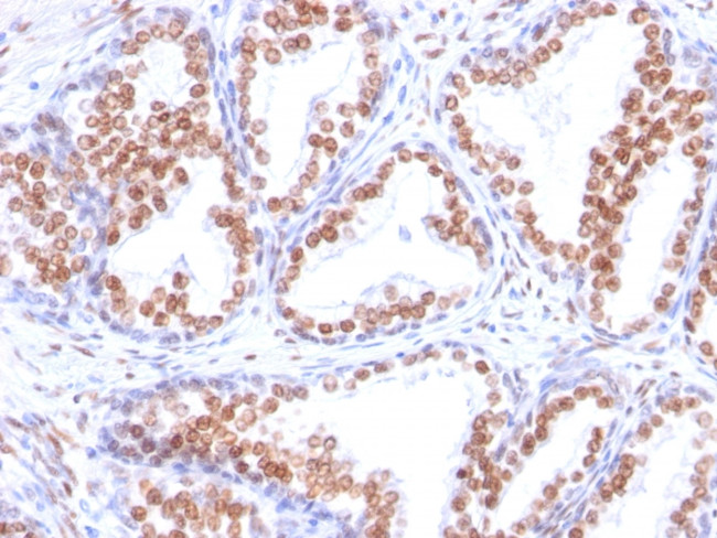 Androgen Receptor (Marker of Androgen Dependence) Antibody in Immunohistochemistry (Paraffin) (IHC (P))