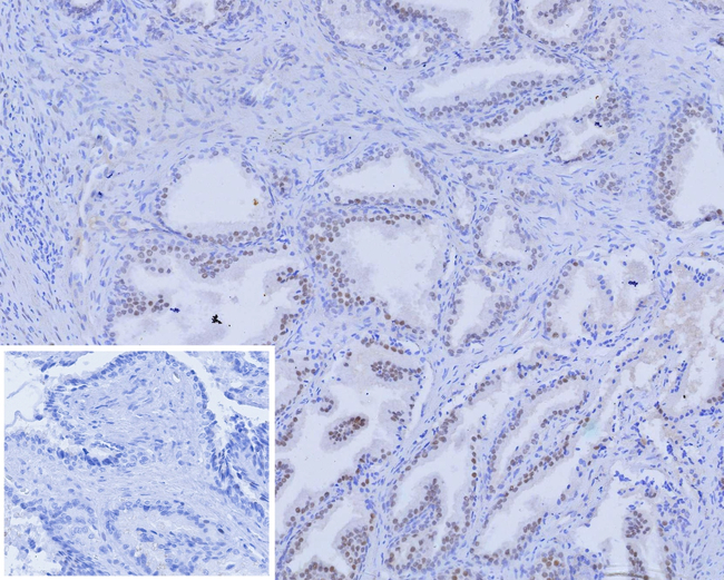 Androgen Receptor (Marker of Androgen Dependence) Antibody in Immunohistochemistry (Paraffin) (IHC (P))