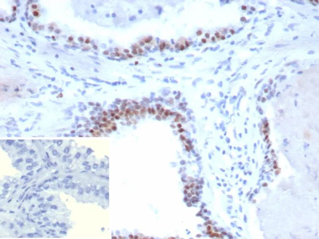 Androgen Receptor V7 (Marker of Androgen Dependence) Antibody in Immunohistochemistry (Paraffin) (IHC (P))
