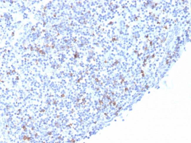 CD103/Integrin alpha-E-beta7 (T-Cell Lymphoma and Hairy Cell Leukemia Marker) Antibody in Immunohistochemistry (Paraffin) (IHC (P))
