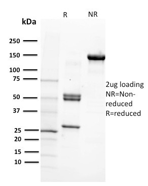 CD29 (Stem Cell Marker) Antibody in SDS-PAGE (SDS-PAGE)