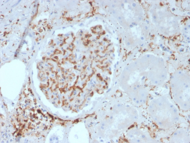 CD29 Antibody in Immunohistochemistry (Paraffin) (IHC (P))