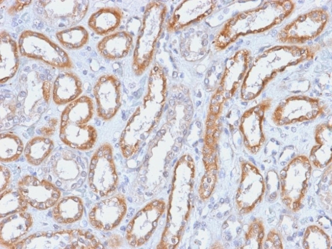 CD61/Integrin 3/Platelet Glycoprotein IIIa Antibody in Immunohistochemistry (Paraffin) (IHC (P))