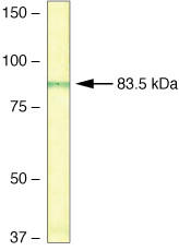 RNaseL Antibody in Western Blot (WB)