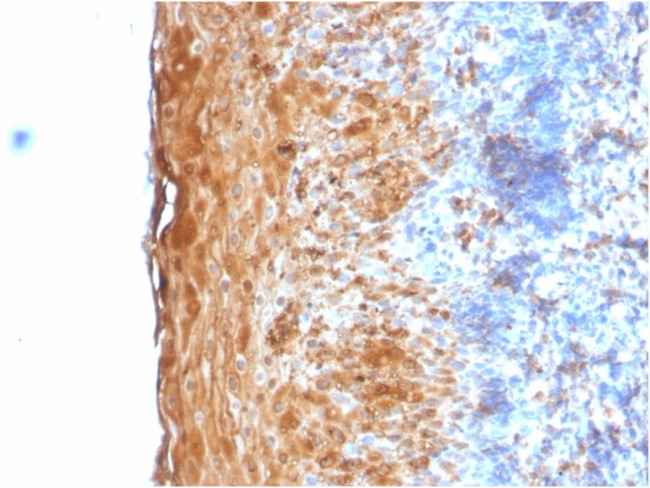 Involucrin Antibody in Immunohistochemistry (Paraffin) (IHC (P))