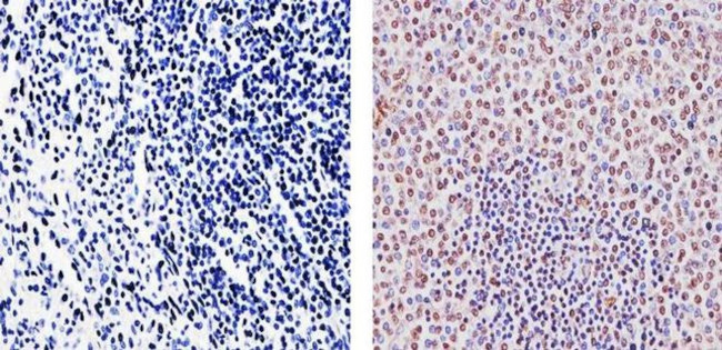 SOCS1 Antibody in Immunohistochemistry (Paraffin) (IHC (P))
