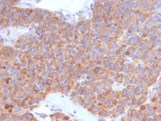 B7-H6/NCR3LG1 (Natural Killer Cell Cytotoxicity Receptor 3 Ligand 1 ...