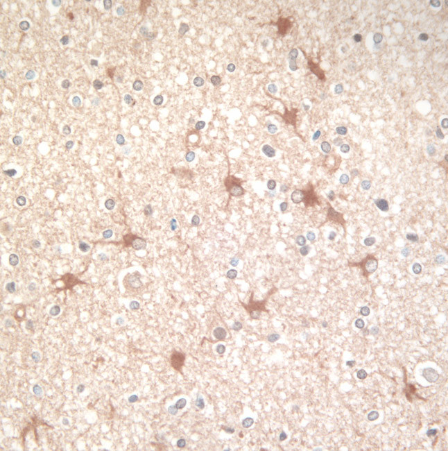 DJ-1 Antibody in Immunohistochemistry (IHC)
