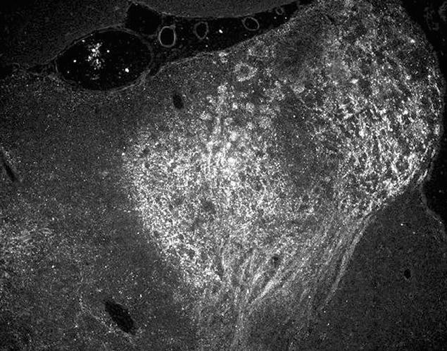 O-acetyl GD3 Antibody in Immunohistochemistry (IHC)