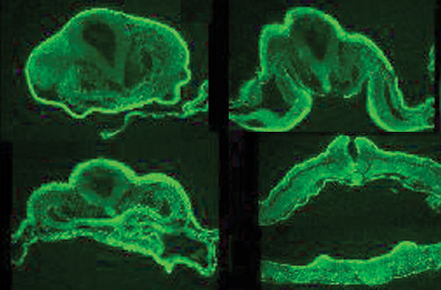 WNT6 Antibody in Immunohistochemistry (IHC)