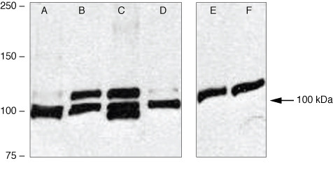 SMURF1 Antibody in Western Blot (WB)