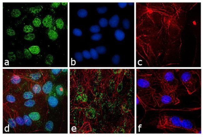 PSME1 Antibody in Immunocytochemistry (ICC/IF)