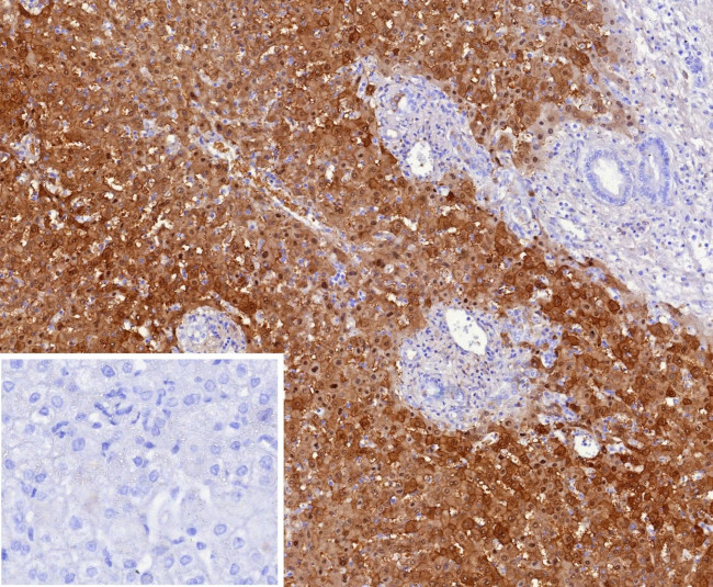 Arginase 1 (Hepatocellular Carcinoma Marker) Antibody in Immunohistochemistry (Paraffin) (IHC (P))