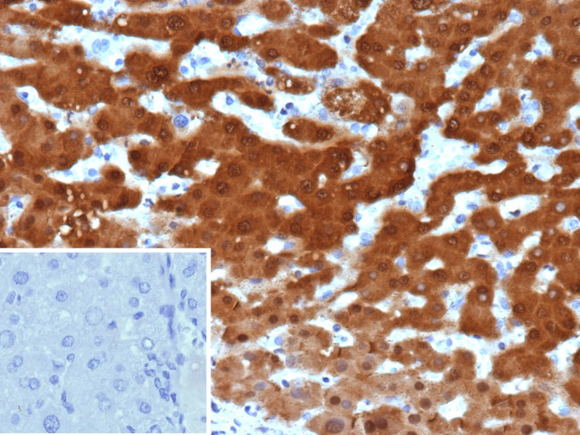 Arginase 1 (Hepatocellular Carcinoma Marker) Antibody in Immunohistochemistry (Paraffin) (IHC (P))