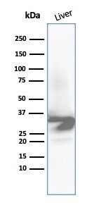 Arginase 1 (Hepatocellular Carcinoma Marker) Antibody in Western Blot (WB)
