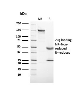 Cytokeratin 3 (KRT3) (Corneal Epithelial Marker) Antibody in SDS-PAGE (SDS-PAGE)
