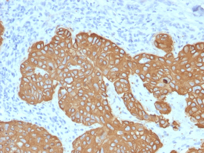 Cytokeratin 5 (KRT5) (Basal, Myoepithelial & Mesothelial Cell Marker) Antibody in Immunohistochemistry (Paraffin) (IHC (P))