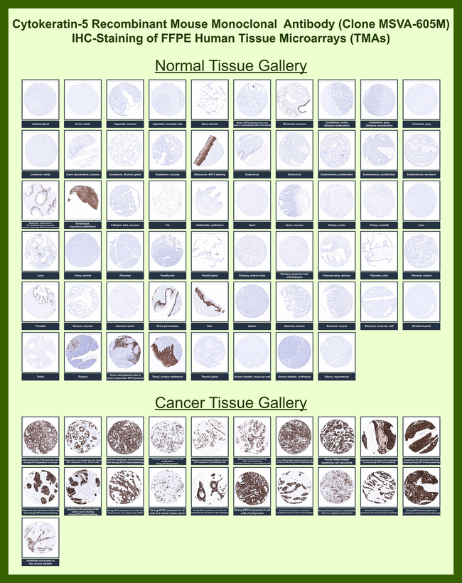 Cytokeratin 5 (KRT5) (Basal, Myoepithelial & Mesothelial Cell Marker) Antibody in Immunohistochemistry (Paraffin) (IHC (P))