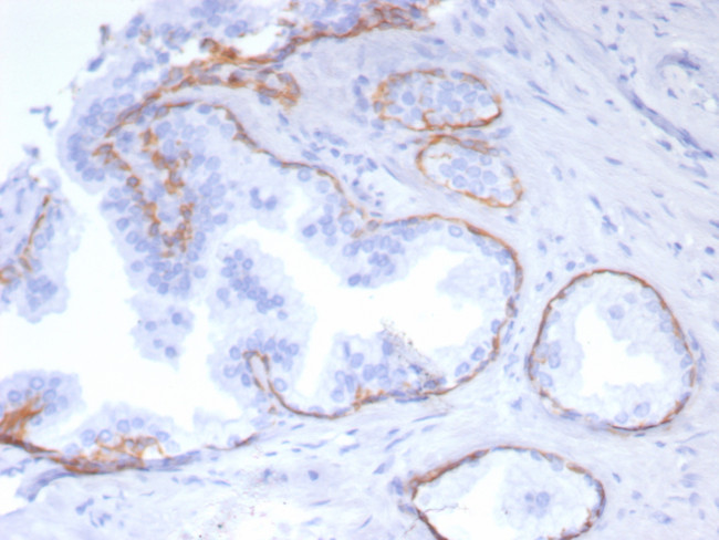 Cytokeratin 5 (KRT5) (Basal, Myoepithelial and Mesothelial Cell Marker) Antibody in Immunohistochemistry (Paraffin) (IHC (P))