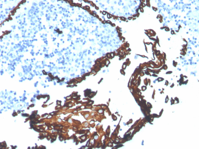 Cytokeratin 5 (KRT5) (Basal, Myoepithelial and Mesothelial Cell Marker) Antibody in Immunohistochemistry (Paraffin) (IHC (P))