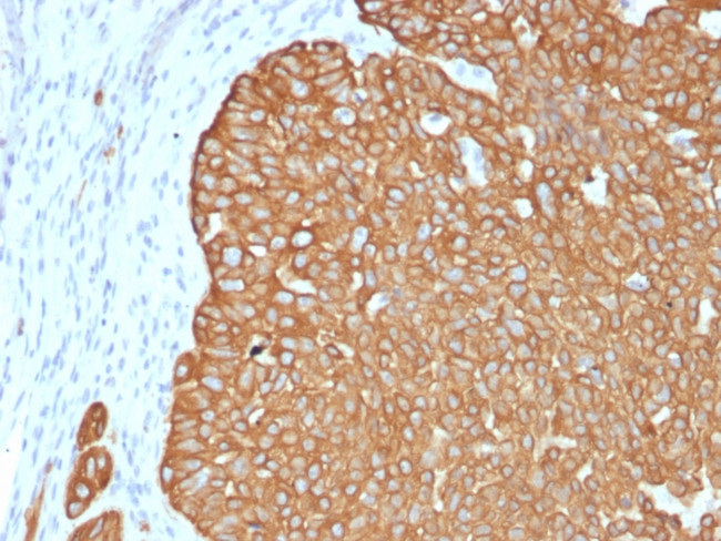 Cytokeratin 5 (KRT5) Antibody in Immunohistochemistry (Paraffin) (IHC (P))